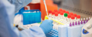 Samples being sperated into tubes by a lab technician.